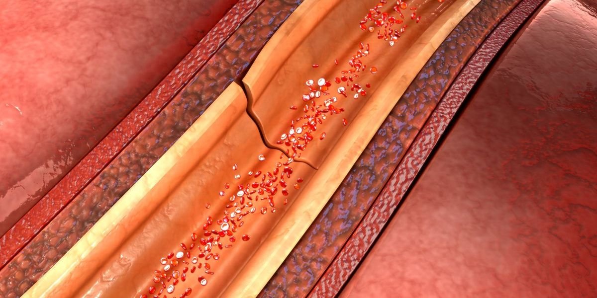 Synthetic Coronary Artery Examination 101