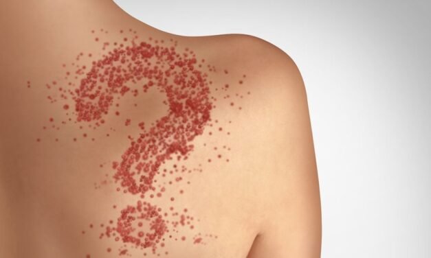 Healthy Women’s Measles Facts