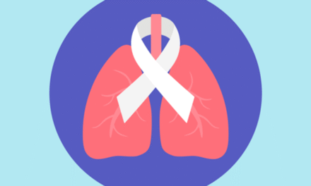 Healthy Women: The Signs of Lung Cancer