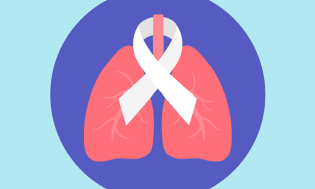 Healthy Women: The Signs of Lung Cancer