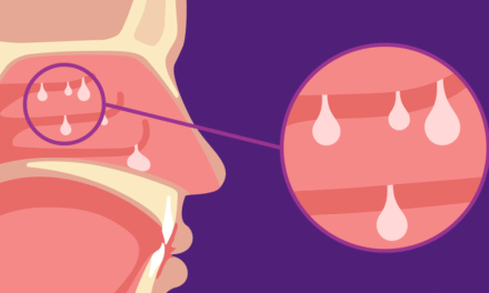 Type 2 Disease and Nasal Polyps