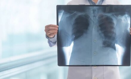 Details About Lung Most cancers Screening