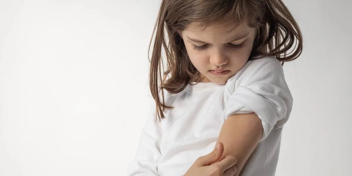 Controlling Pediatric Atopic Dermatitis