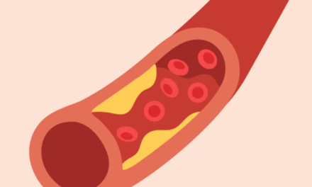 Healthy Women: Atherosclerosis and brain disease