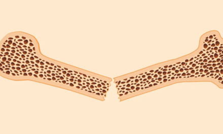 HealthyWomen- Tratamientos de la fracture