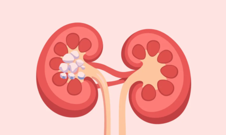 Healthy Women’s Treatments for Primary Hyperoxaluria