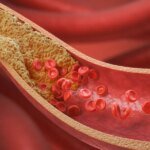 What Women Should Know About Lipid