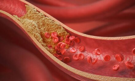 What Women Should Know About Lipid