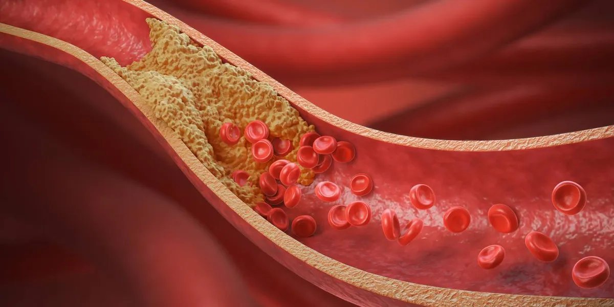 What Women Should Know About Lipid