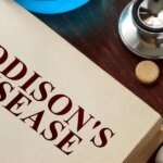 How does Addison’s Disorder manifest? HealthyWomen