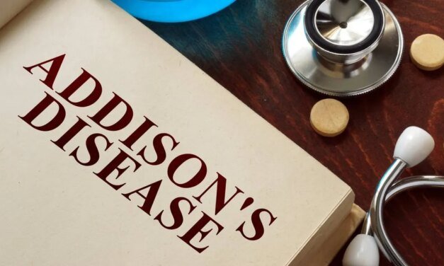 How does Addison’s Disorder manifest? HealthyWomen