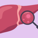 Info About Liver Illness – HealthyWomen