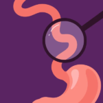 Eosinophilic esophagitis ( EoE ) symptoms