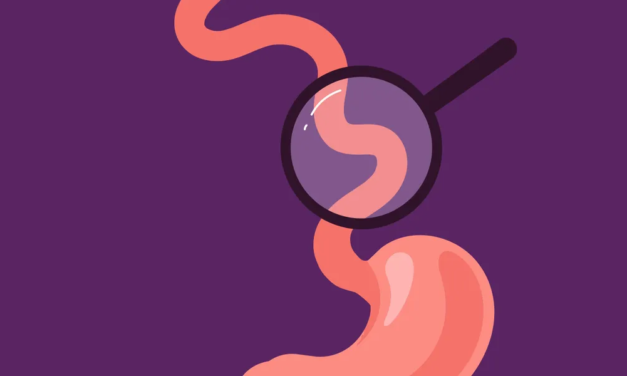 Eosinophilic esophagitis ( EoE ) symptoms