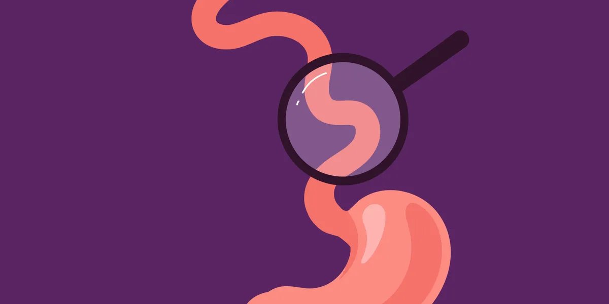 Eosinophilic esophagitis ( EoE ) symptoms