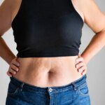 Menopause Stomach – HealthyWomen