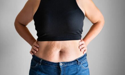 Menopause Stomach – HealthyWomen