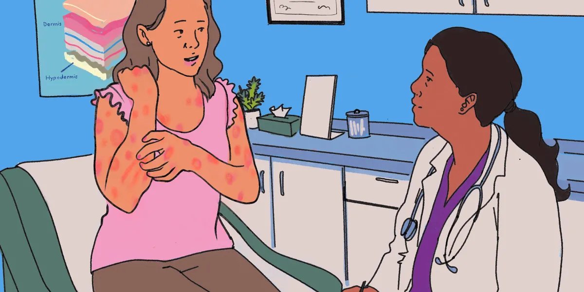 Holly has unexpected, serious urticaria.