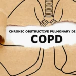 Frequently asked questions about the EPOC