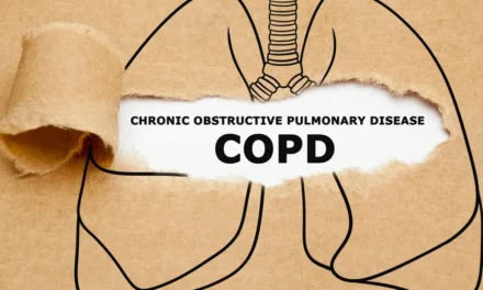 Frequently asked questions about the EPOC