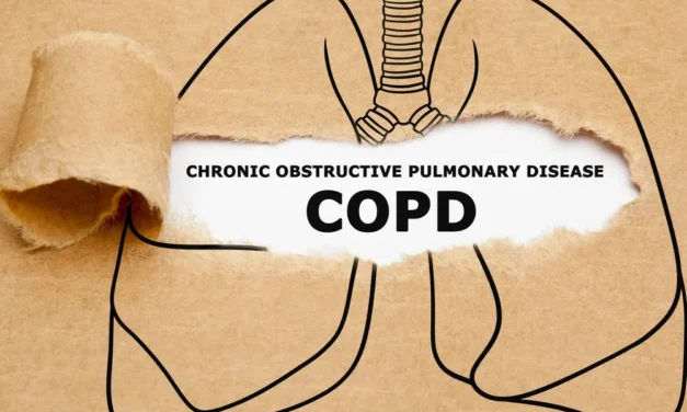 Frequently asked questions about the EPOC