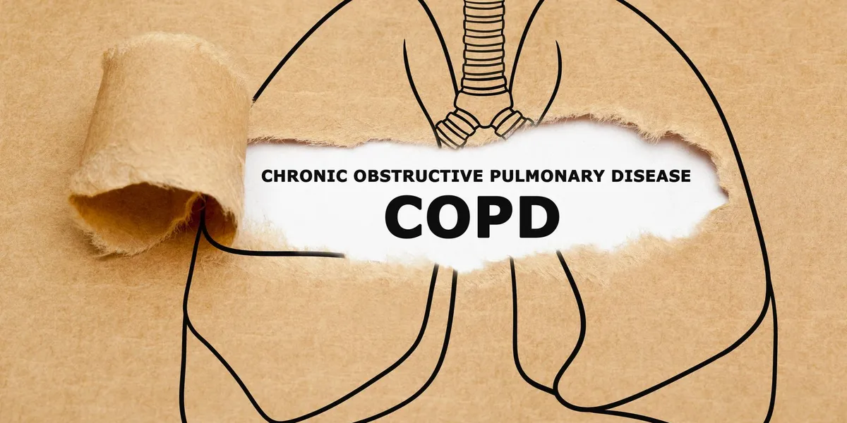 Frequently asked questions about the EPOC