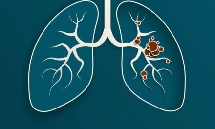 How Do Lung Most cancers Biomarkers Assist Information Remedy?