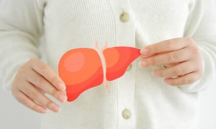 What Is MASLD, Also known as Fatty Liver Disease?