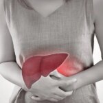 Details About Liver Most cancers – HealthyWomen